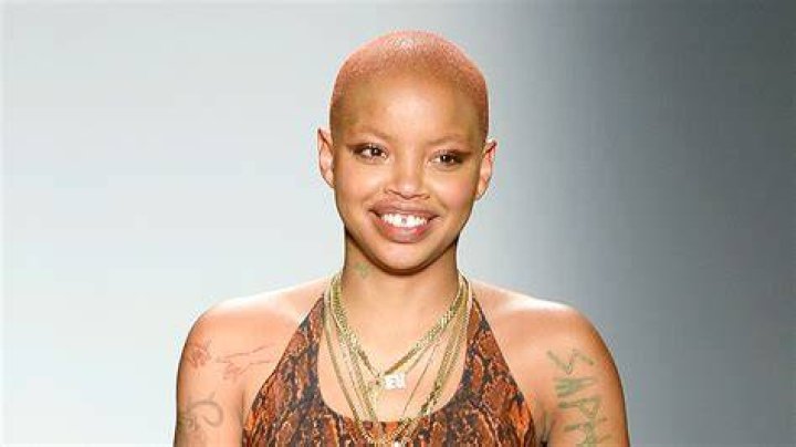Model Slick Woods Shares Smiling Update After Seizure Allure